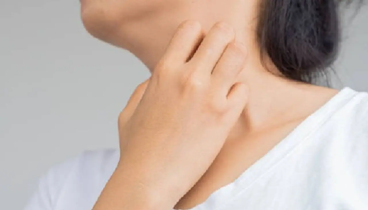 skin itching skin itching