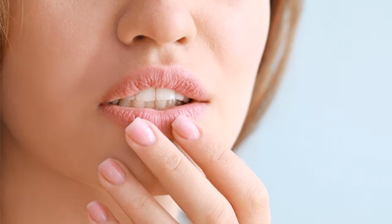 chapped lips chapped lips