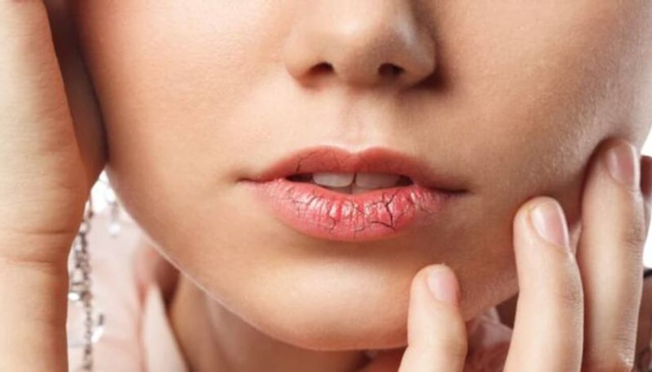 Tips For Chapped Lips In Winter In Tamil