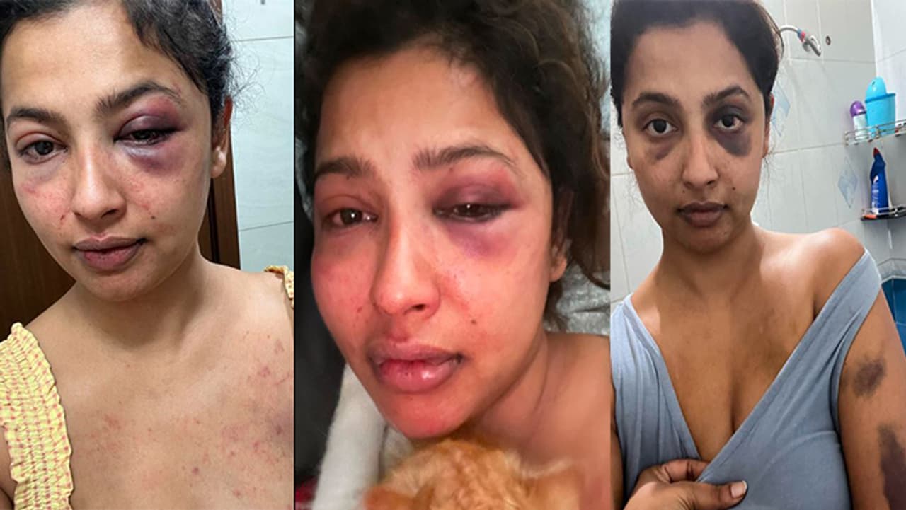 एक्स बॉयफ्रेंड ने की मारपीट एक्स बॉयफ्रेंड ने की मारपीट