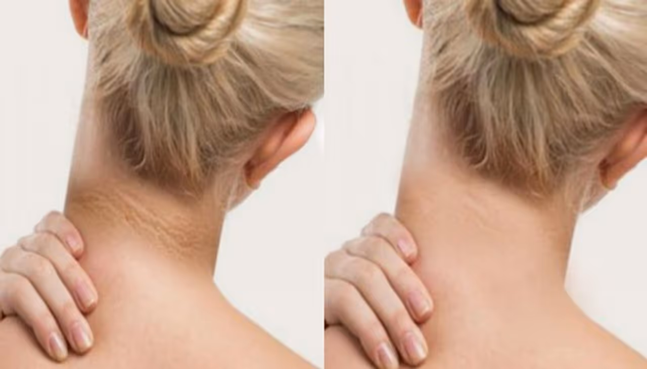 1 ஸ்பூன் தயிர் போதும்.. கழுத்து கருமையை முற்றிலும் நீக்கலாம்! 1 ஸ்பூன் தயிர் போதும்.. கழுத்து கருமையை முற்றிலும் நீக்கலாம்!