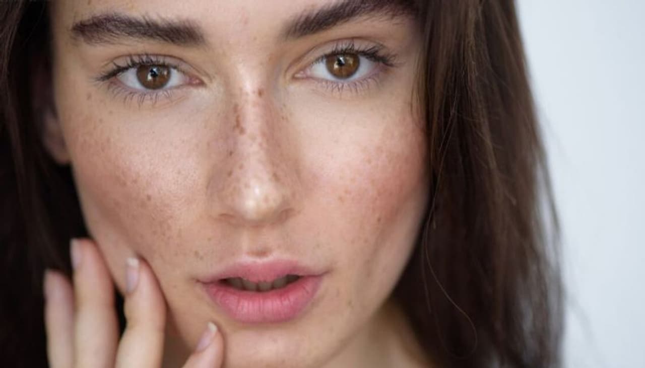 dark spots dark spots