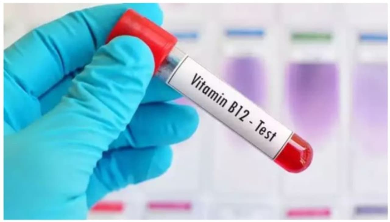 vitamin b12 deficiency vitamin b12 deficiency