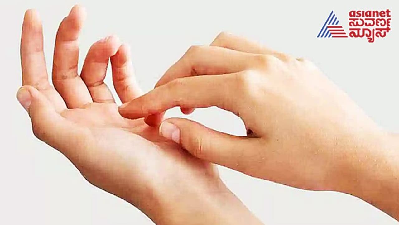 Itching in palms Itching in palms