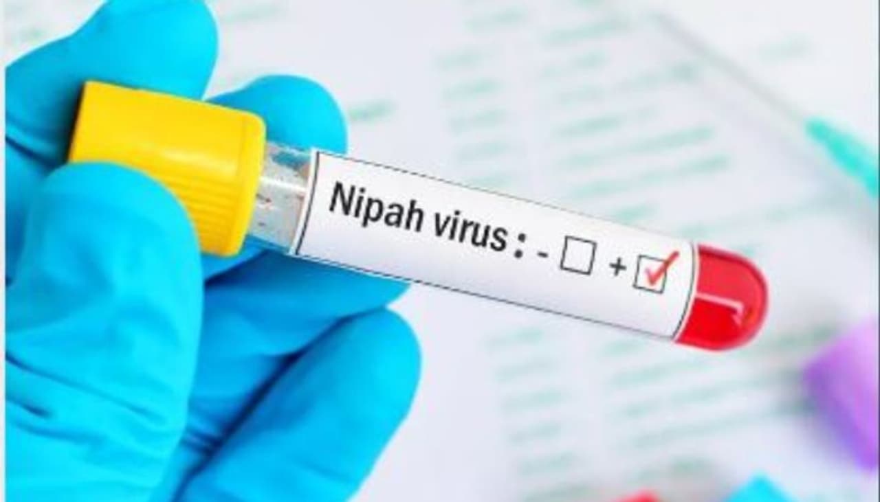 nipah virus