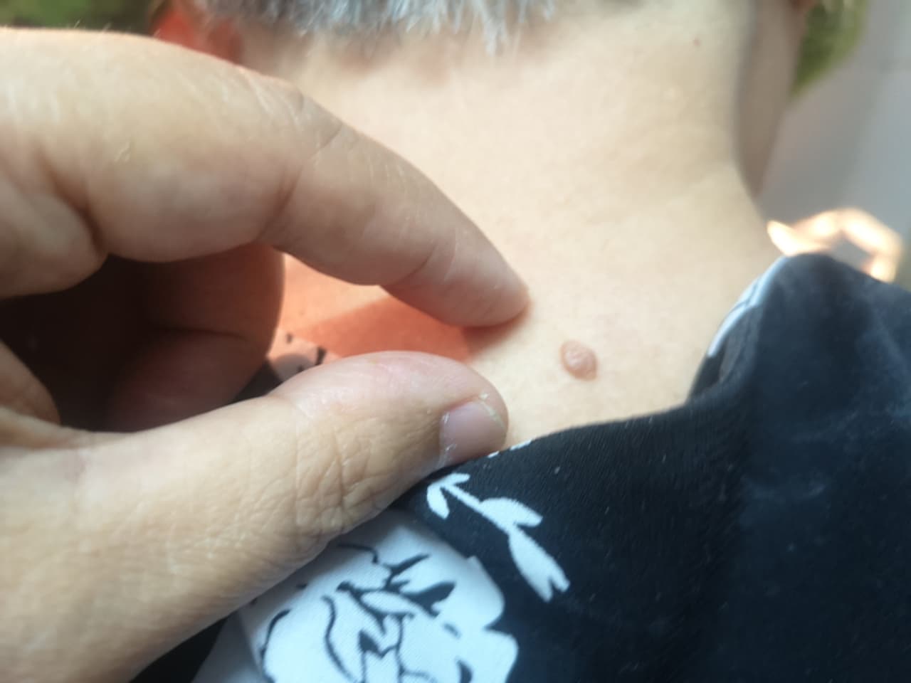 ಅಂದವನ್ನ ಹಾಳುಮಾಡುತ್ತವೆ ಅಂದವನ್ನ ಹಾಳುಮಾಡುತ್ತವೆ