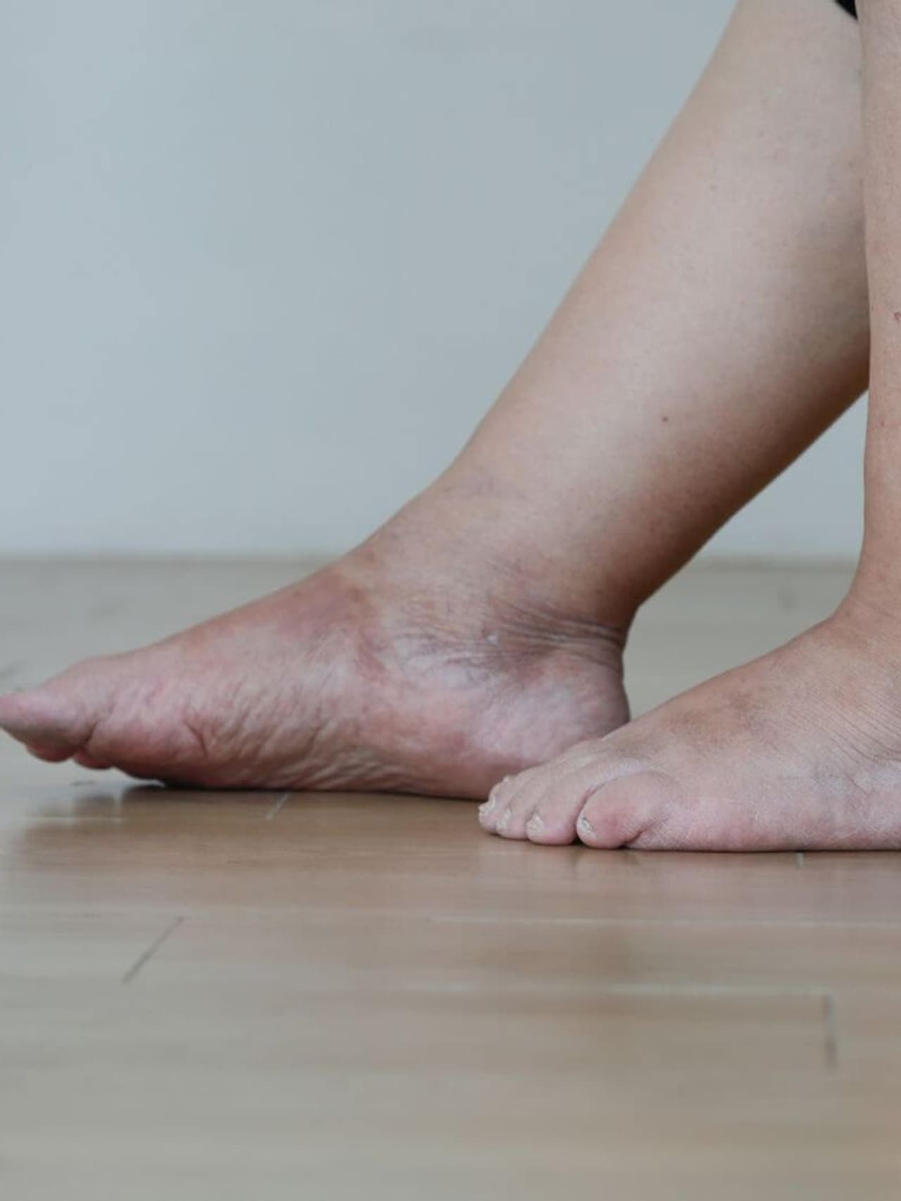 Causes Of Swelling During Pregnancy In Tamil