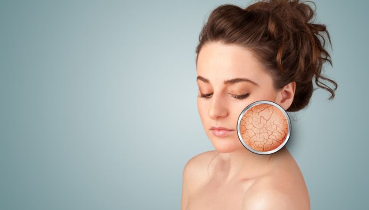 dry skin home remedy