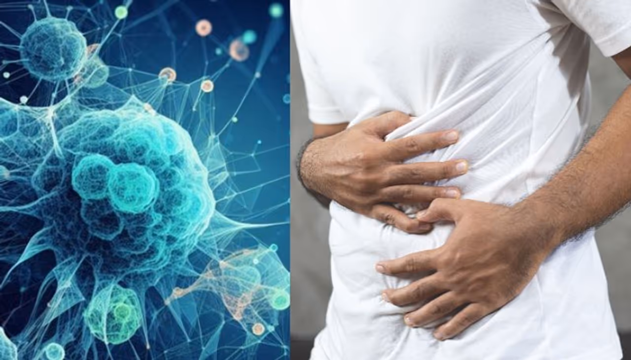 stomach cancer stomach cancer