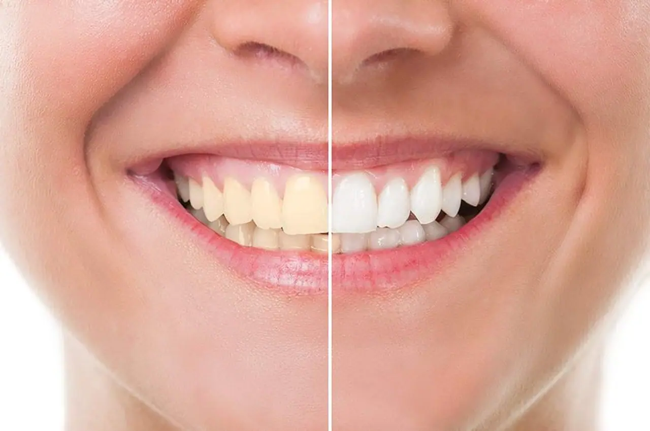 white teeth tips in tamil white teeth tips in tamil
