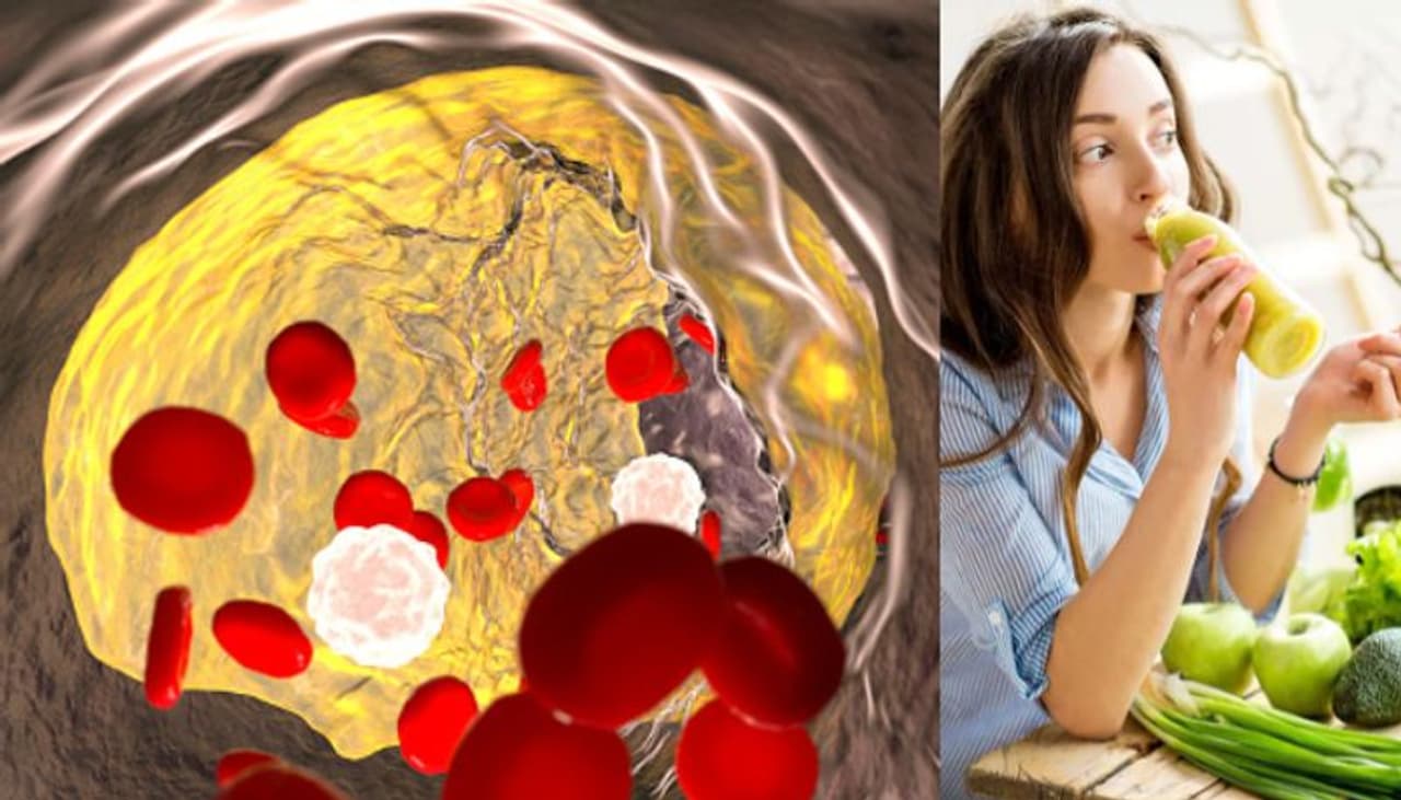 cholesterol cholesterol