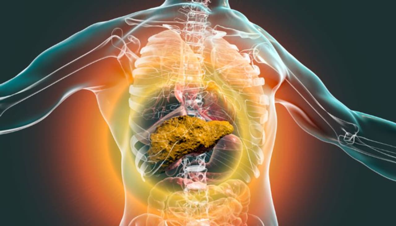 लिव्हर सिरोसिसची महत्त्वाची लक्षणं लिव्हर सिरोसिसची महत्त्वाची लक्षणं