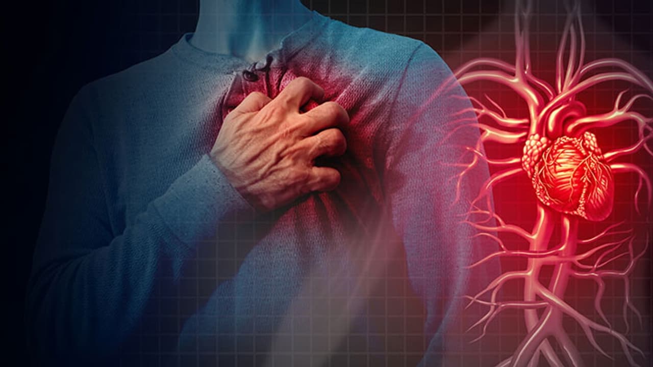 Heart Attack Heart Attack