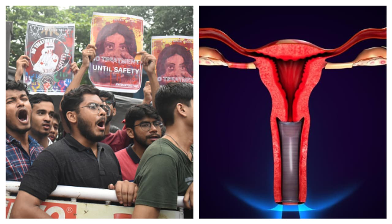 আরজি করে তরুণী খুন ও ধর্ষণ আরজি করে তরুণী খুন ও ধর্ষণ