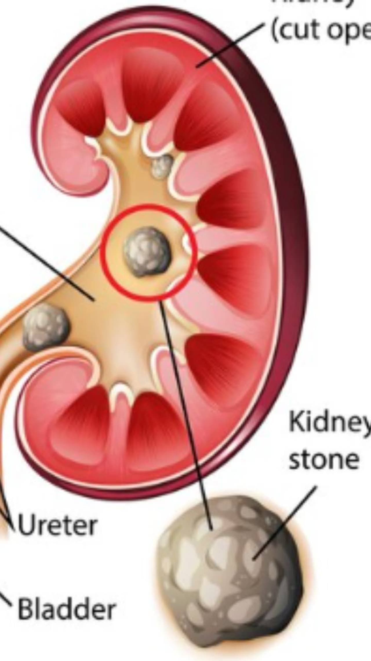 ಈ ಸಮಸ್ಯೆಯಿಂದ ಹೊರಬರಲು 