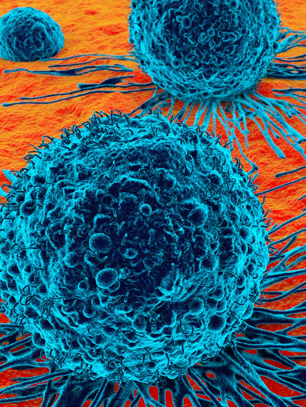 ಅತ್ಯಂತ ಮಾರಕ ಕಾಯಿಲೆ ಅತ್ಯಂತ ಮಾರಕ ಕಾಯಿಲೆ