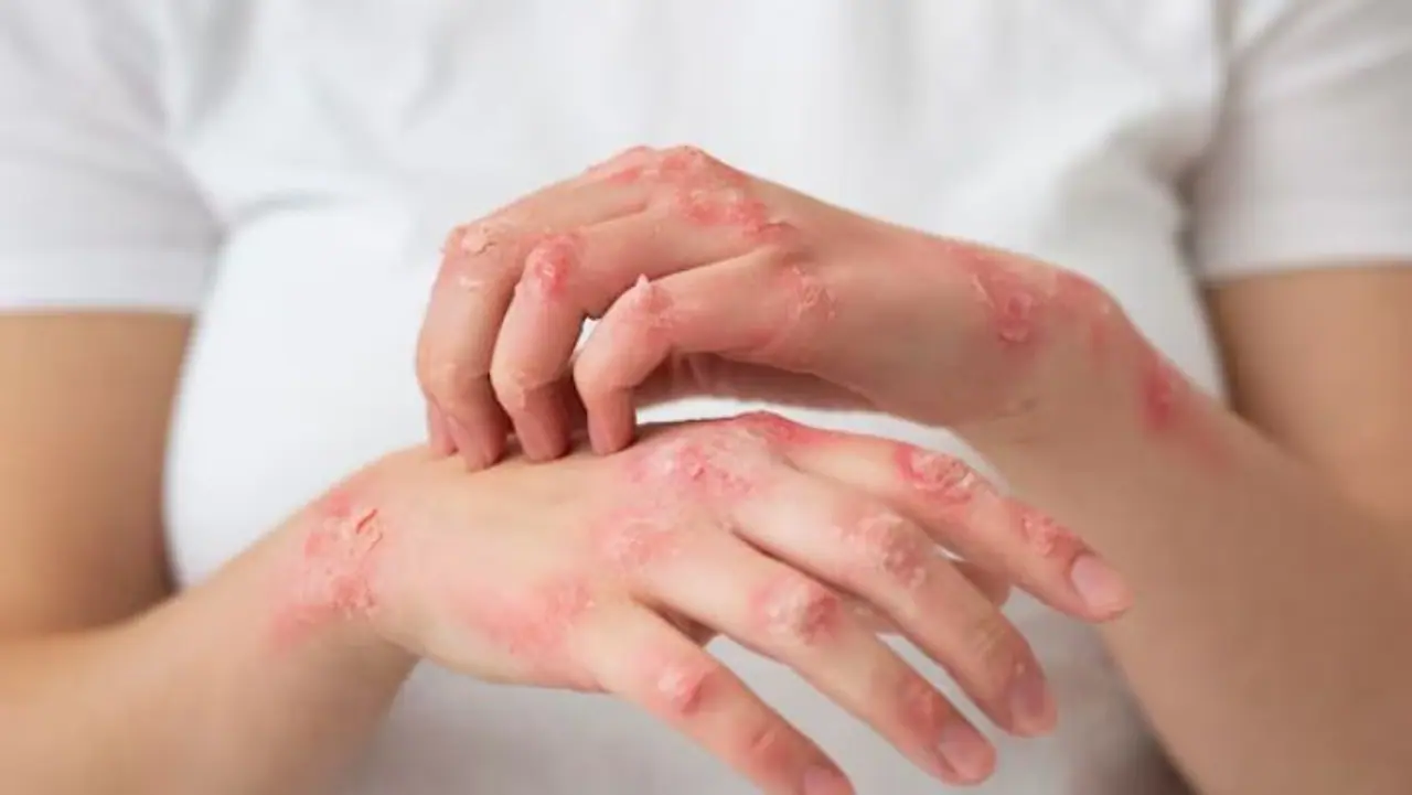 स्थानिक प्रशासन आणि आरोग्य यंत्रणा सतर्क स्थानिक प्रशासन आणि आरोग्य यंत्रणा सतर्क