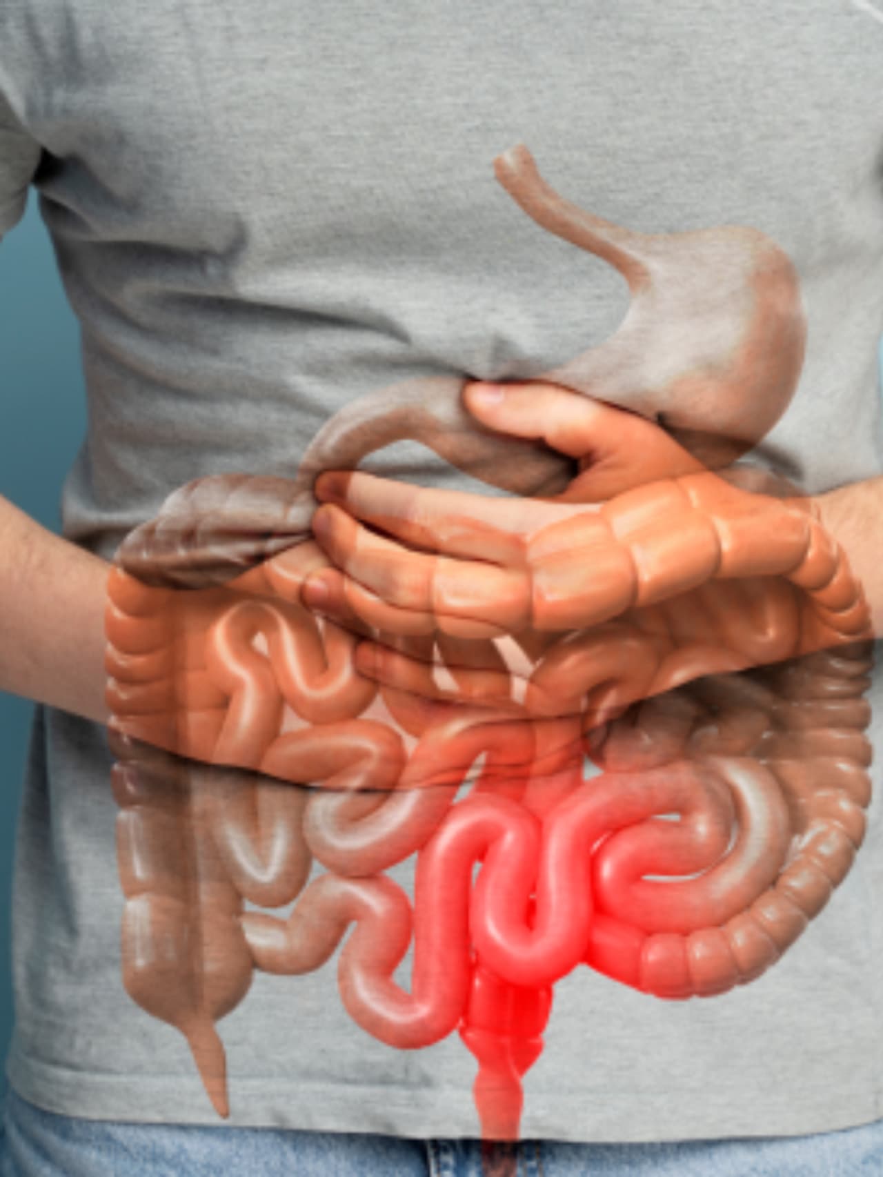 పెద్ద ప్రేగు క్యాన్సర్ (Colon Cancer) పెద్ద ప్రేగు క్యాన్సర్ (Colon Cancer)