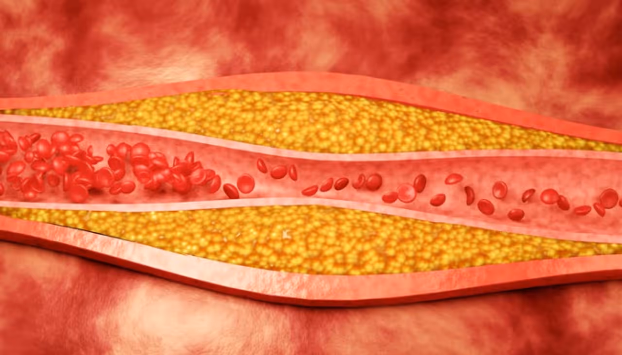 वाईट कोलेस्ट्रॉल कमी करण्यासाठी फायदेशीर पाने
