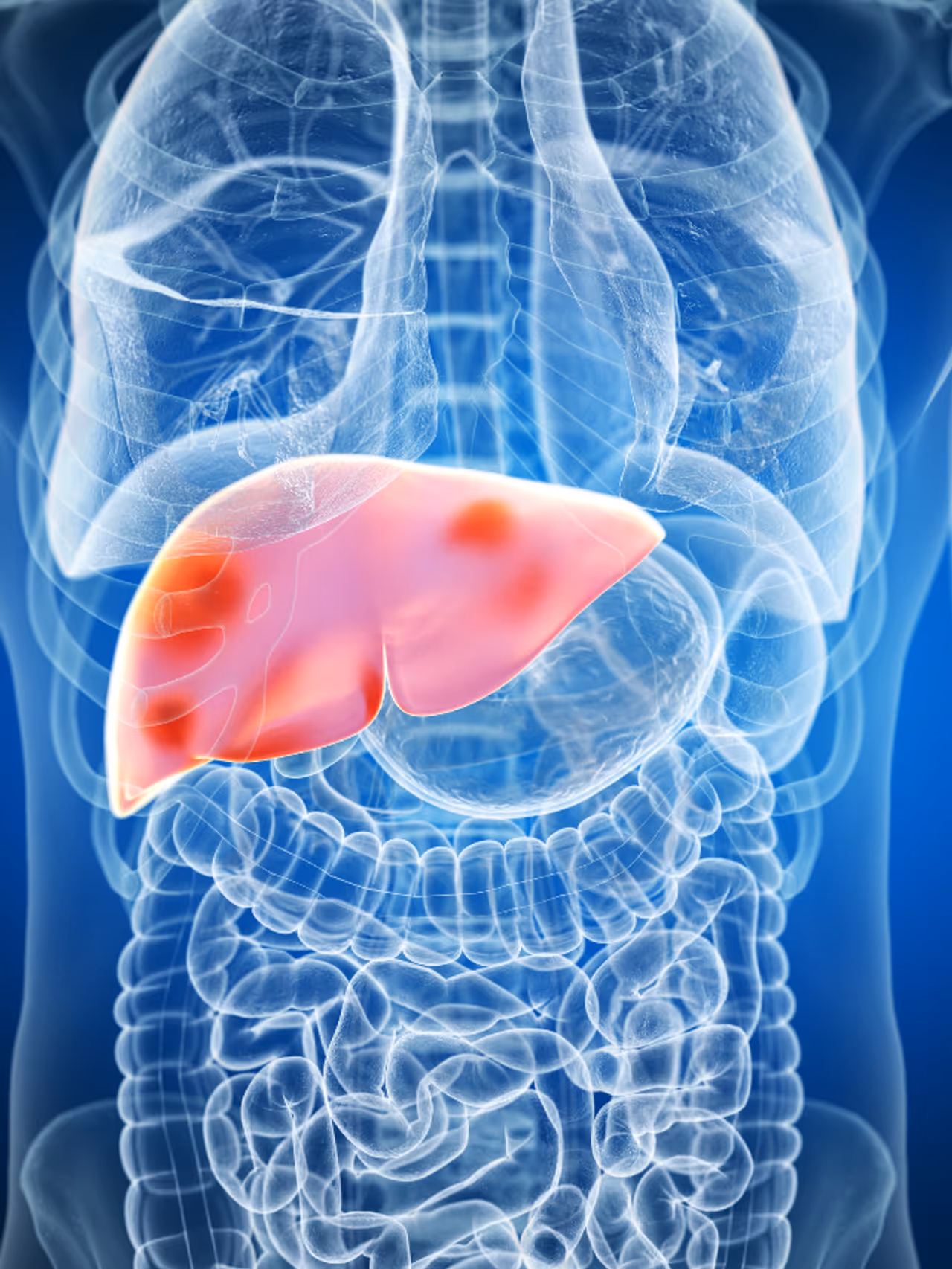 কী কারণে হয় ফ্যাটি লিভার? 