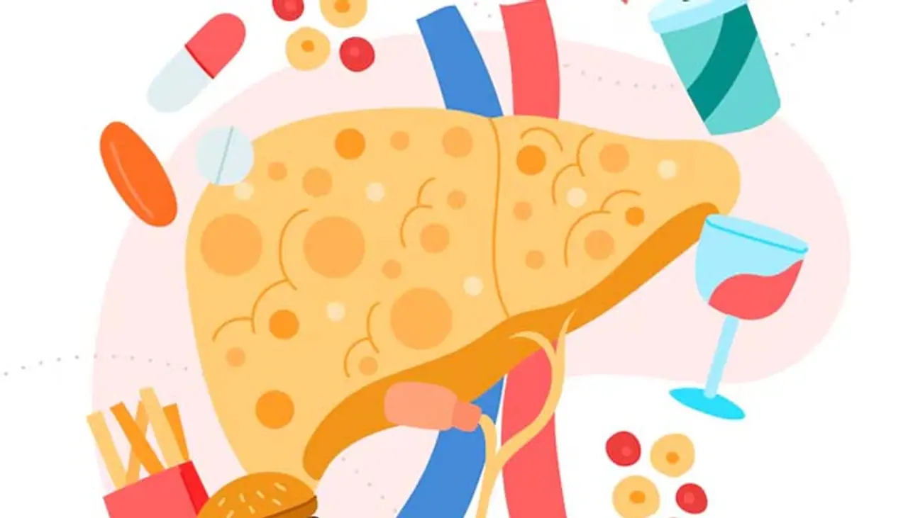 7 Scientifically Proven ingredients to treat Fatty Liver