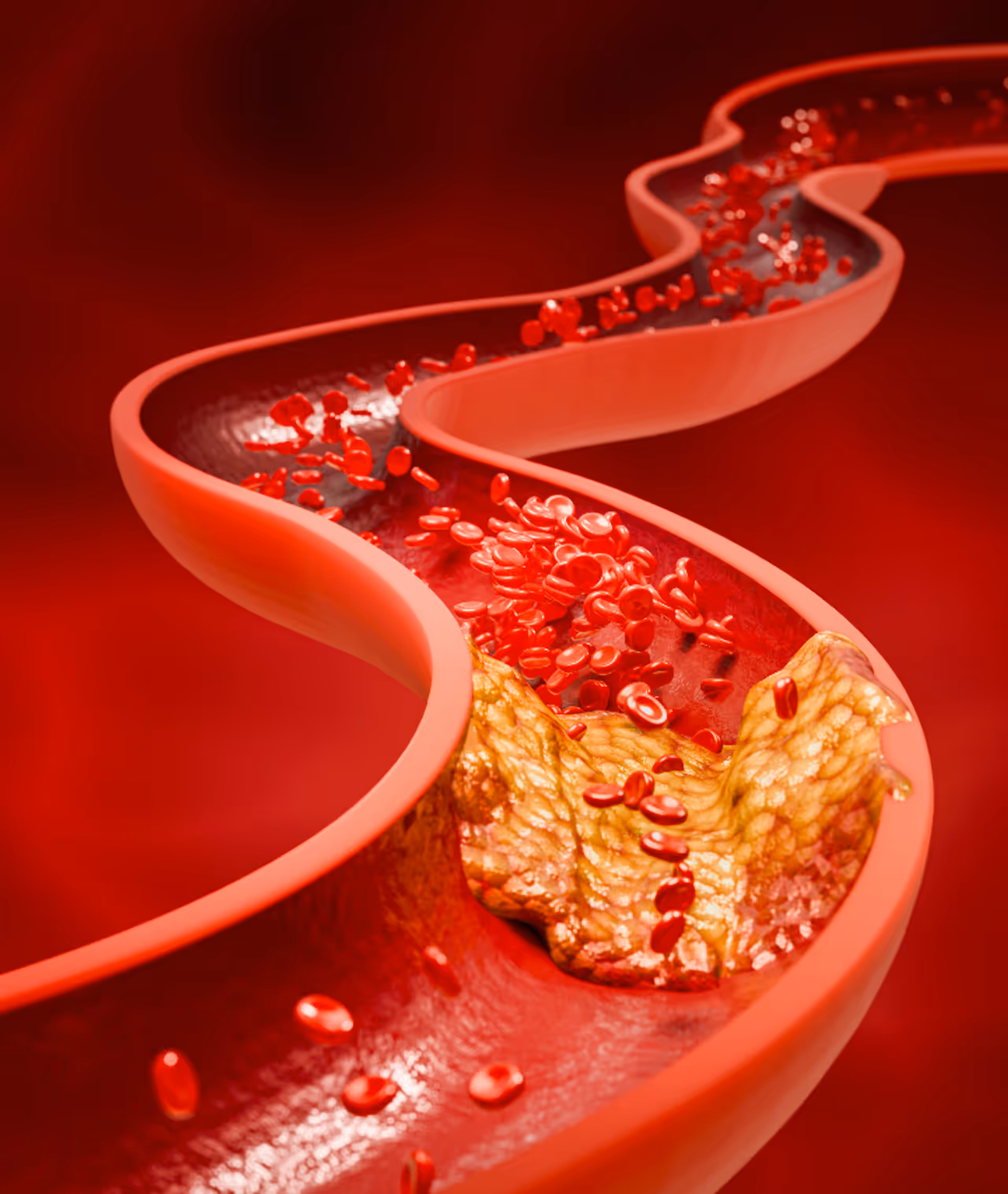 പ്രോസസിഡ് ഭക്ഷണങ്ങള് ഒഴിവാക്കുക പ്രോസസിഡ് ഭക്ഷണങ്ങള് ഒഴിവാക്കുക