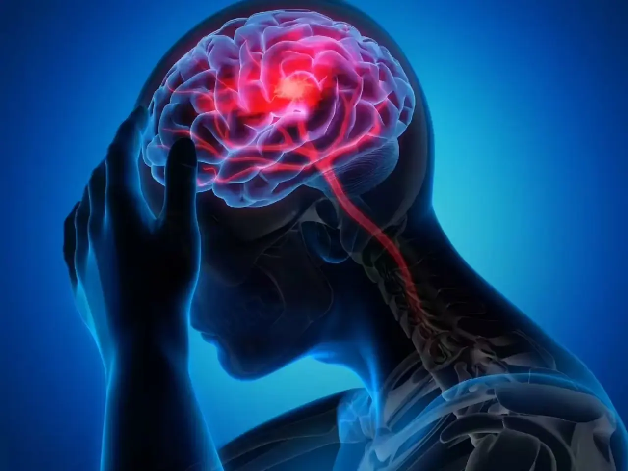 6 signs that warn you of a stroke a month in advance