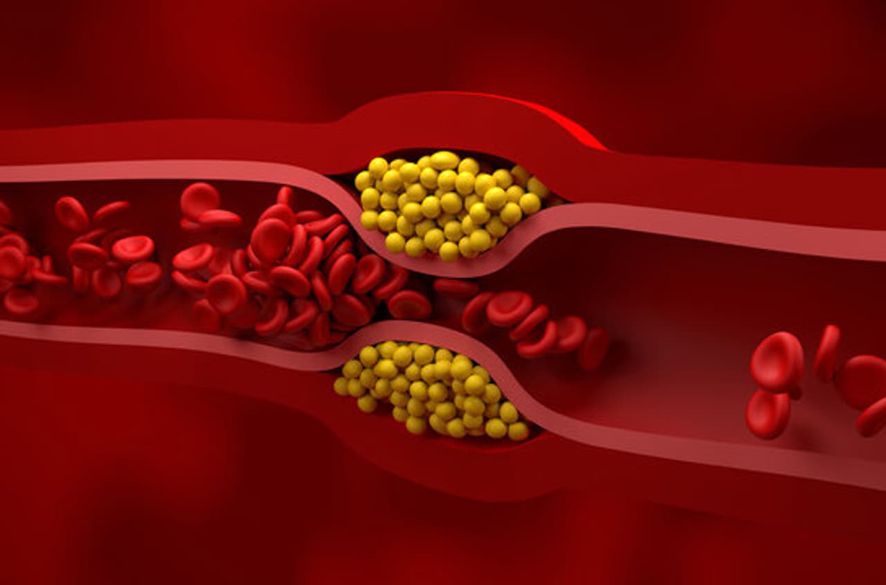 How to Reduce Bad Cholesterol