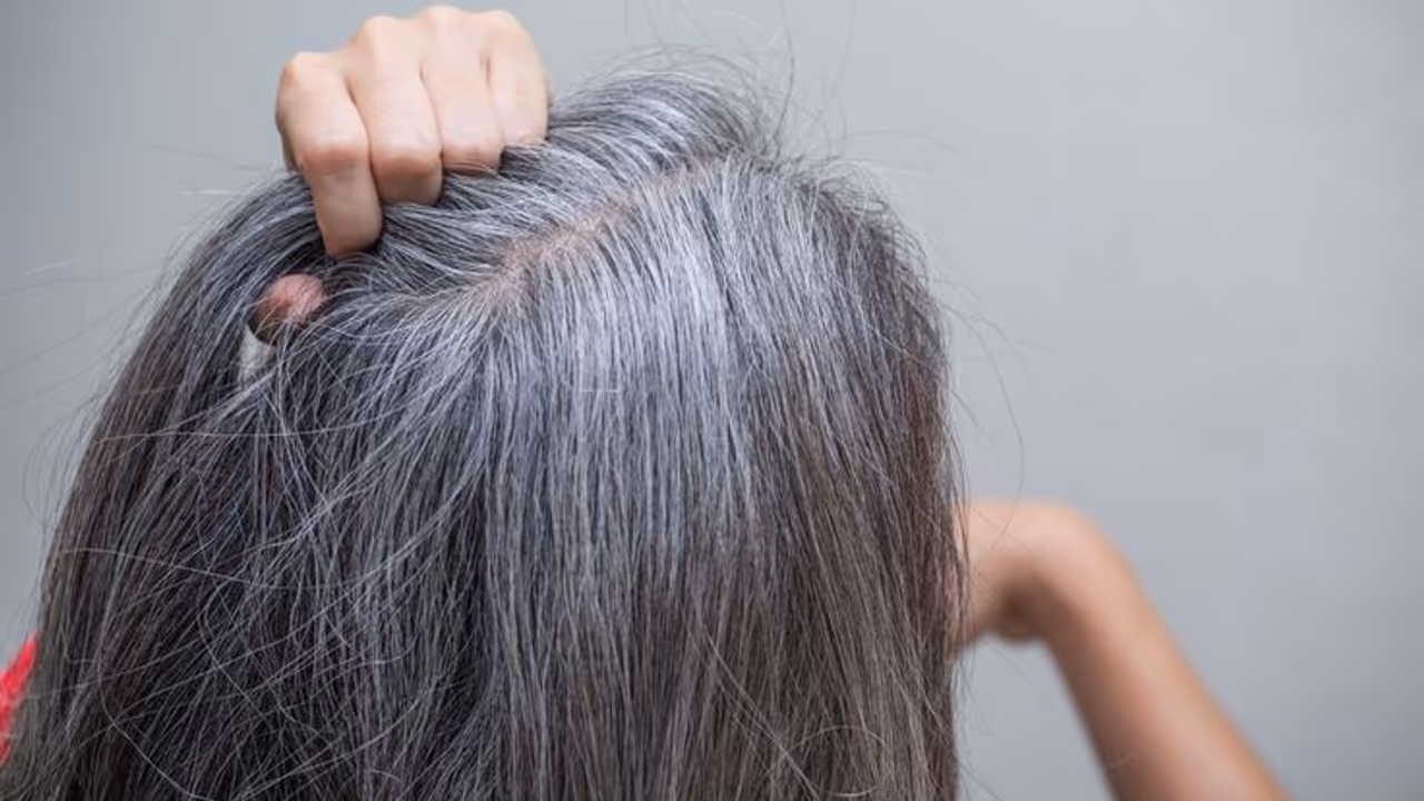 Home Remedies for Premature Greying