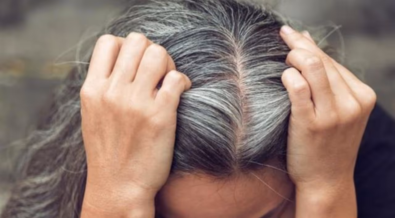 Foods That Prevent Grey Hair
