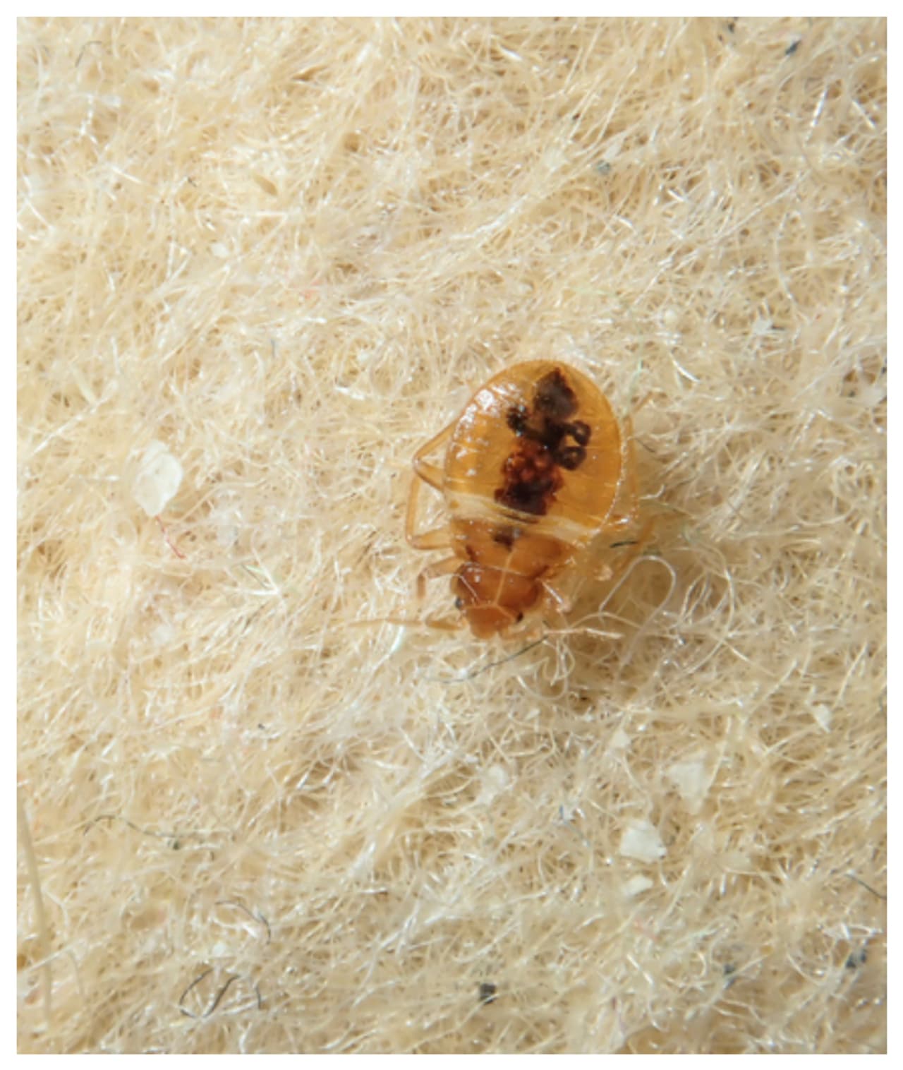 ತುರಿಕೆ ಮಾತ್ರವಲ್ಲ, ಸೋಂಕೂ ಉಂಟು ಮಾಡುತ್ತೆ 