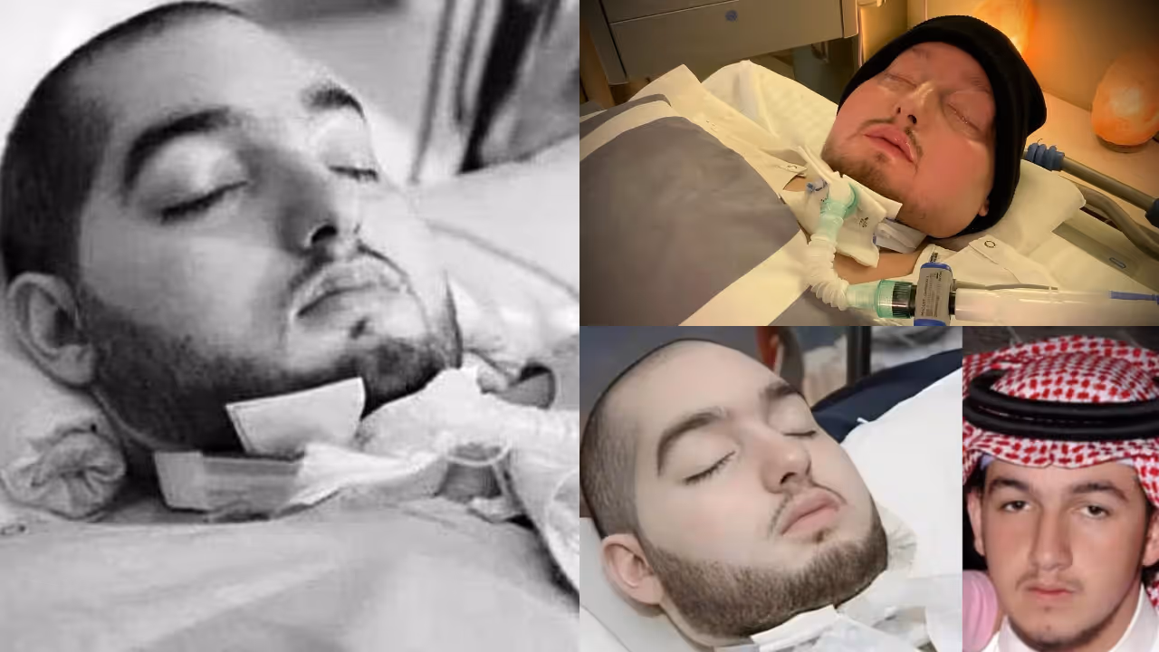 ಚಿರನಿದ್ರೆಗೆ ಜಾರಿದ ಸ್ಲೀಪಿಂಗ್ ಪ್ರಿನ್ಸ್‌