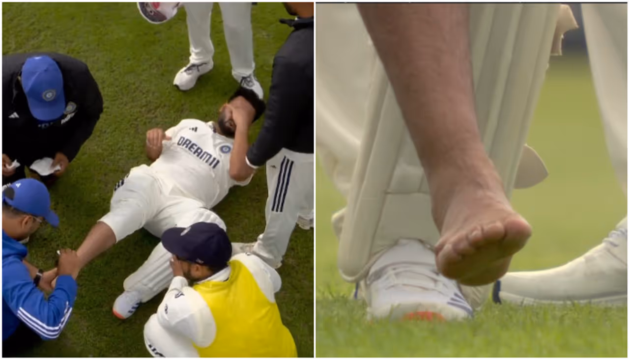 IND vs ENG 4th Test: Rishabh Pant Injured For Ball Hit Leg