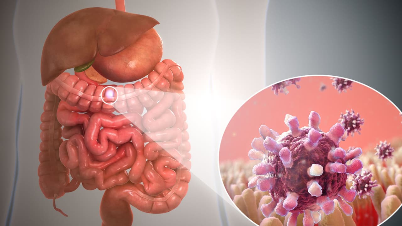 ಗ್ಯಾಸ್ ಟ್ರಬಲ್ ಅಂದ್ರೆ ಏನು?