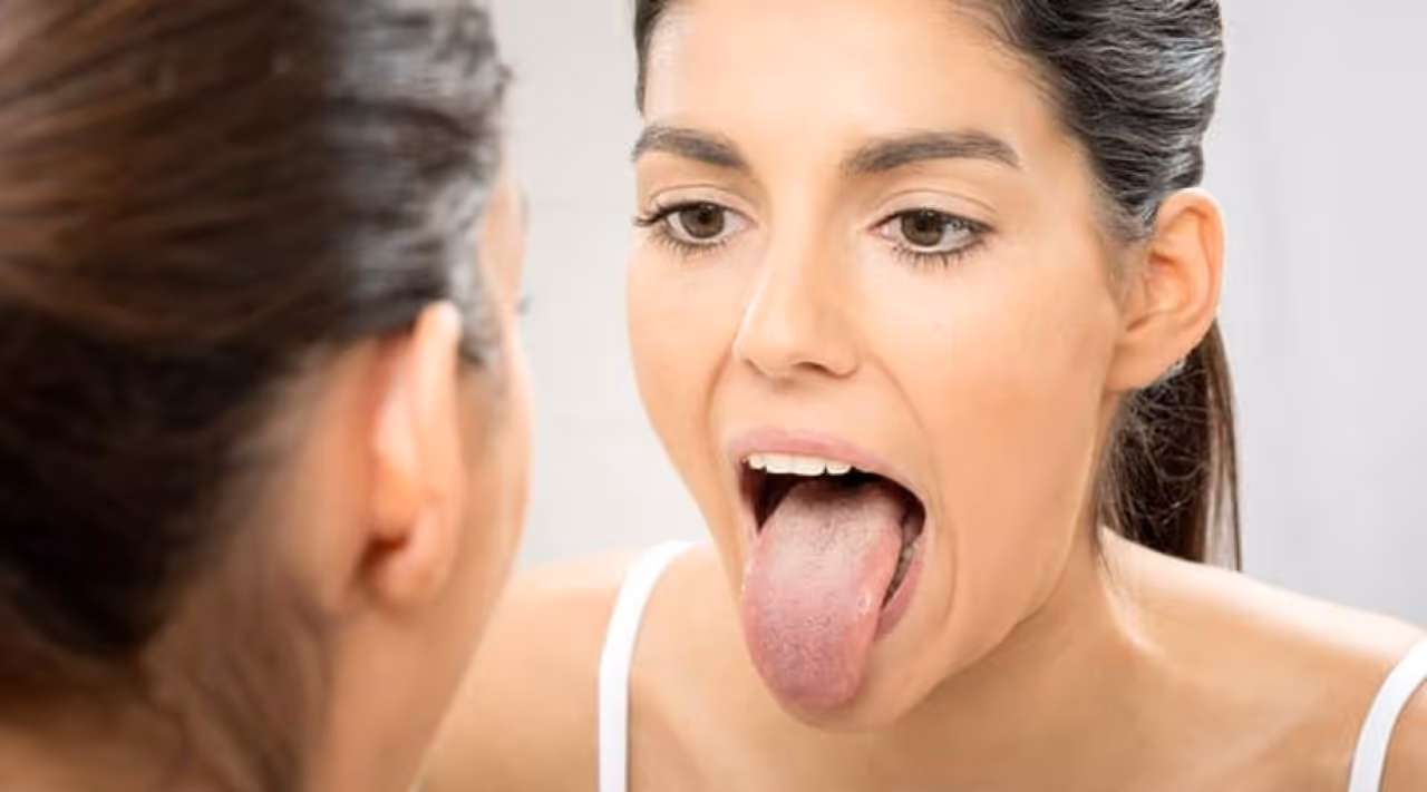 నాలుక రంగు ఆధారంగా వ్యాధులు 