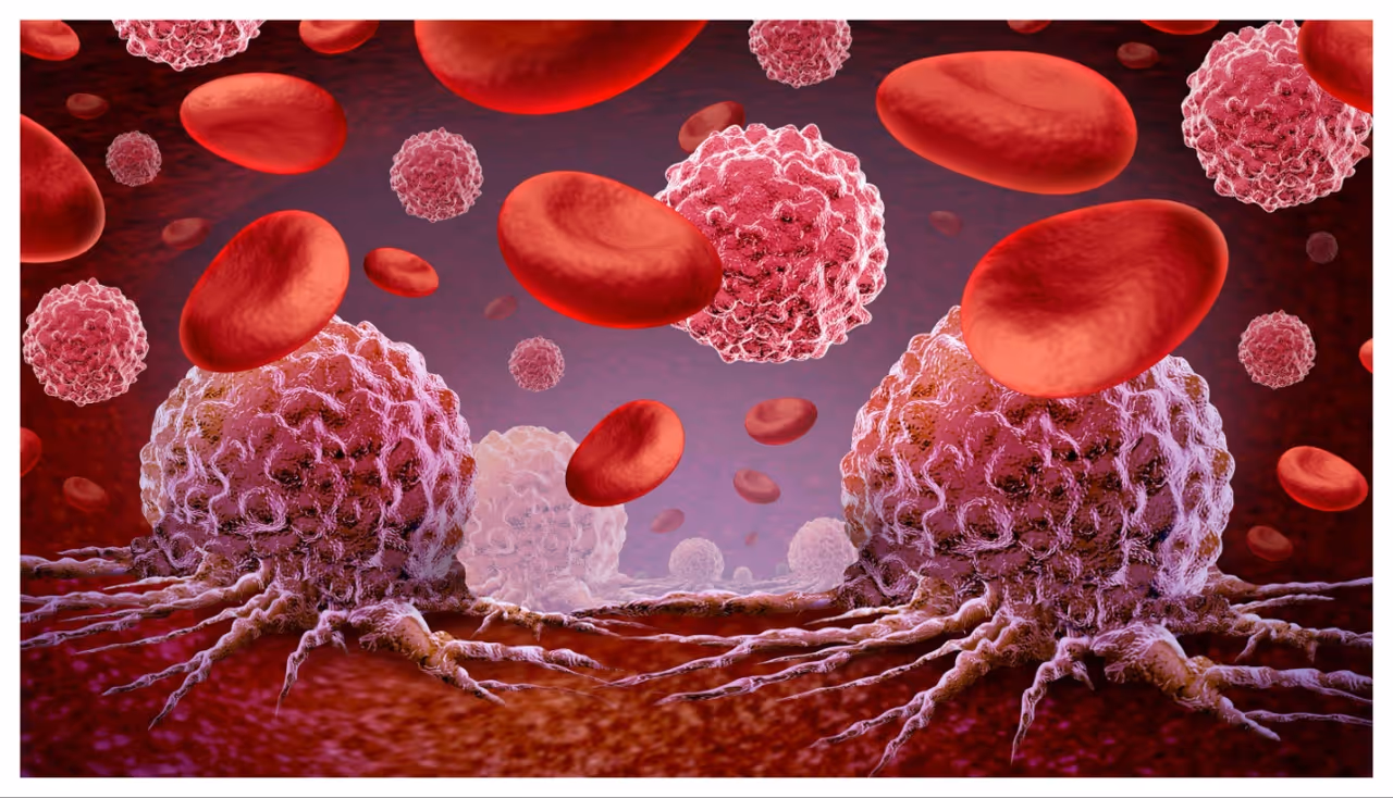 ప్రాణాంతక వ్యాధి క్యాన్సర్