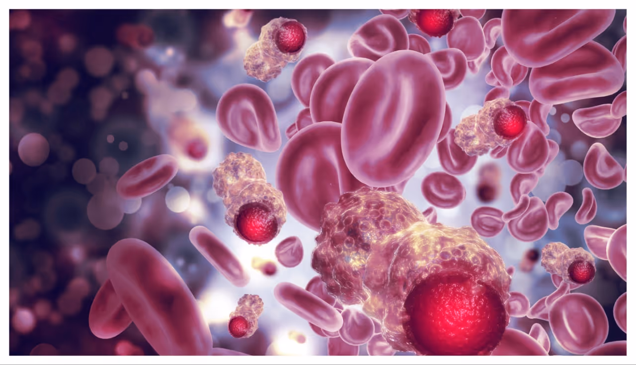 ക്യാൻസർ സാധ്യത കുറയ്ക്കുന്ന ഭക്ഷണങ്ങൾ ക്യാൻസർ സാധ്യത കുറയ്ക്കുന്ന ഭക്ഷണങ്ങൾ