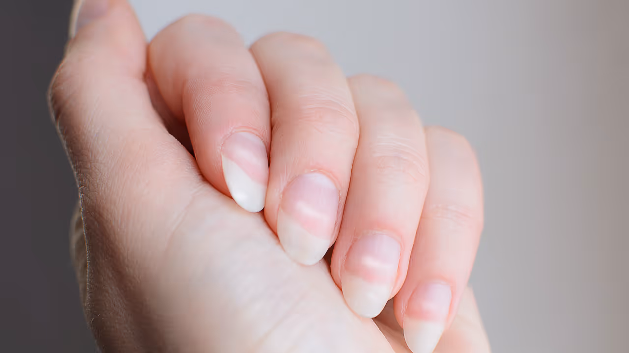 Lacking protein in your body? Foods you should eat Lacking protein in your body? Foods you should eat