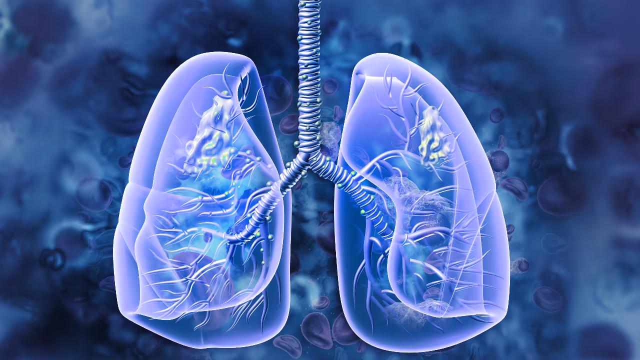 ശ്വാസകോശാരോഗ്യം മെച്ചപ്പെടുത്തുന്ന 10 സൂപ്പർഫുഡുകൾ ശ്വാസകോശാരോഗ്യം മെച്ചപ്പെടുത്തുന്ന 10 സൂപ്പർഫുഡുകൾ