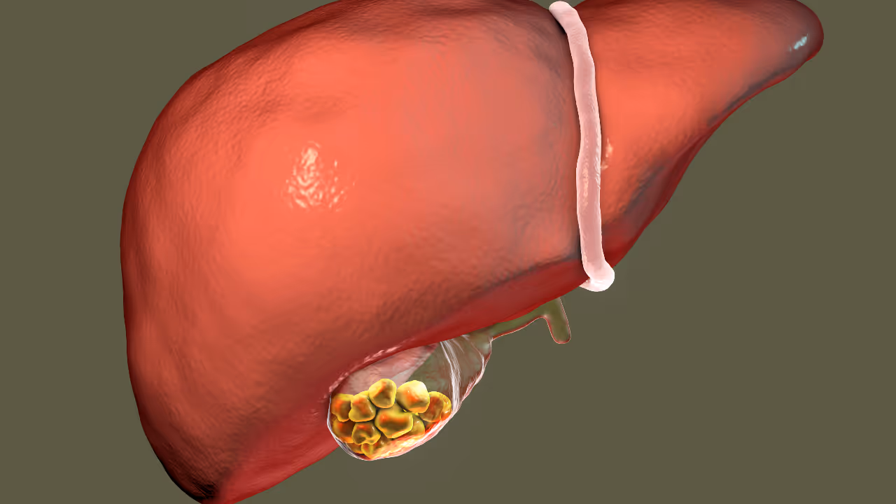 പിത്താശയക്കല്ല്; ഈ ലക്ഷണങ്ങളെ നിസാരമായി കാണേണ്ട