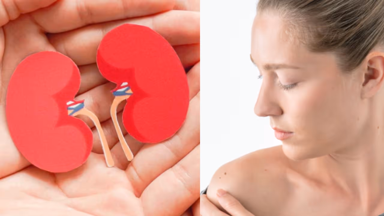 కిడ్నీ స‌మ‌స్య‌ల‌ను చ‌ర్మం చెప్పేస్తుంది