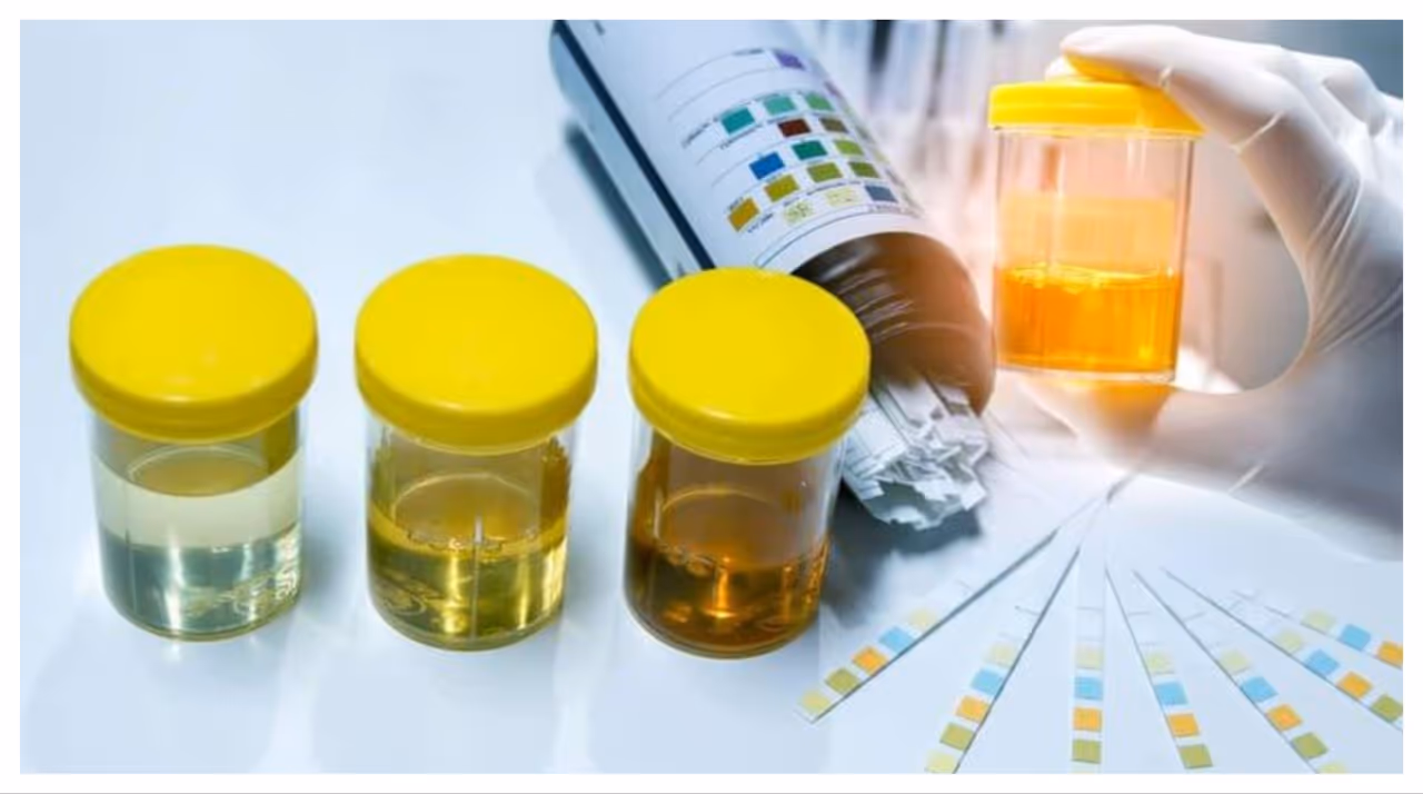 മൂത്രത്തിൽ രക്തം കണ്ടാൽ നിസാരമായി കാണരുത്, കാരണം ഇതാണ് മൂത്രത്തിൽ രക്തം കണ്ടാൽ നിസാരമായി കാണരുത്, കാരണം ഇതാണ്