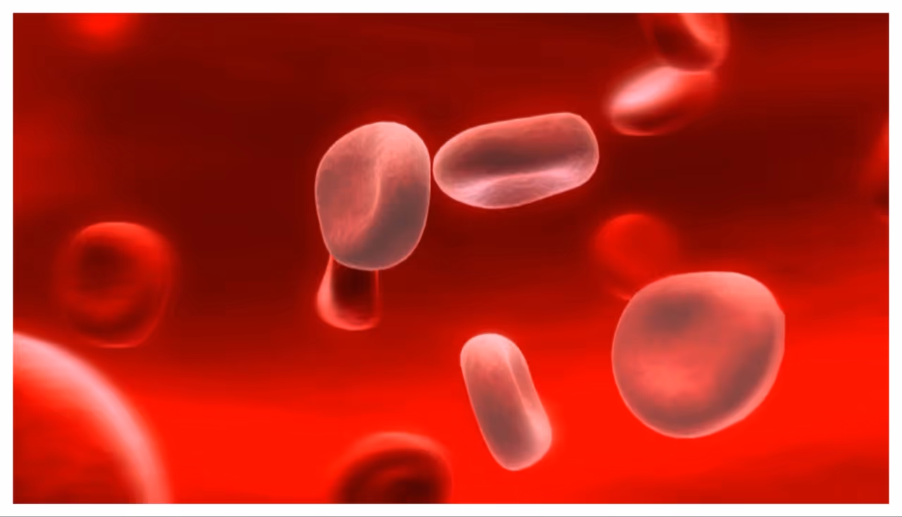 ഈ ലക്ഷണങ്ങൾ നിങ്ങൾക്കുണ്ടോ? ഇരുമ്പിന്റെ കുറവ് കൊണ്ട് വരുന്നതാകാം ഈ ലക്ഷണങ്ങൾ നിങ്ങൾക്കുണ്ടോ? ഇരുമ്പിന്റെ കുറവ് കൊണ്ട് വരുന്നതാകാം