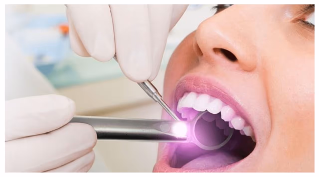 വായിലെ ക്യാൻസർ ; ശരീരം കാണിക്കുന്ന ചില പ്രാരംഭ ലക്ഷണങ്ങൾ വായിലെ ക്യാൻസർ ; ശരീരം കാണിക്കുന്ന ചില പ്രാരംഭ ലക്ഷണങ്ങൾ