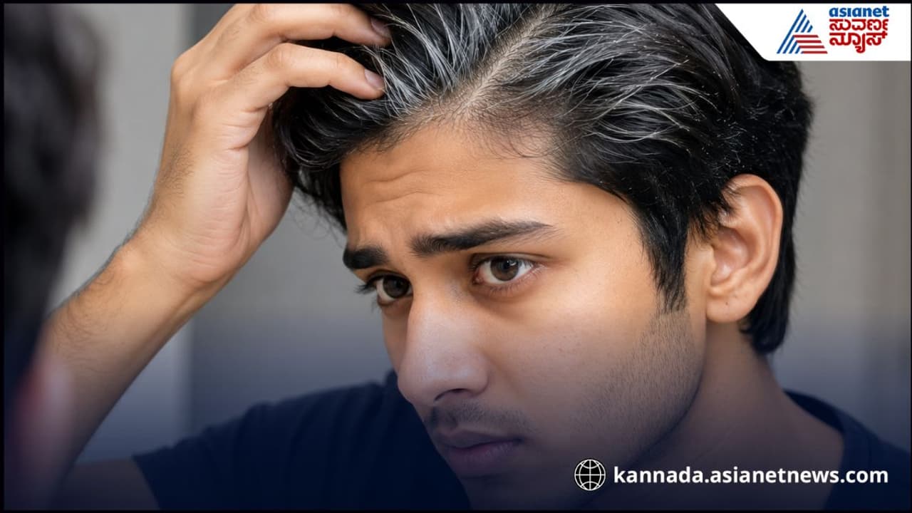 ಚಿಕ್ಕ ವಯಸ್ಸಿನಲ್ಲೇ ಬಿಳಿ ಕೂದಲು ಚಿಕ್ಕ ವಯಸ್ಸಿನಲ್ಲೇ ಬಿಳಿ ಕೂದಲು