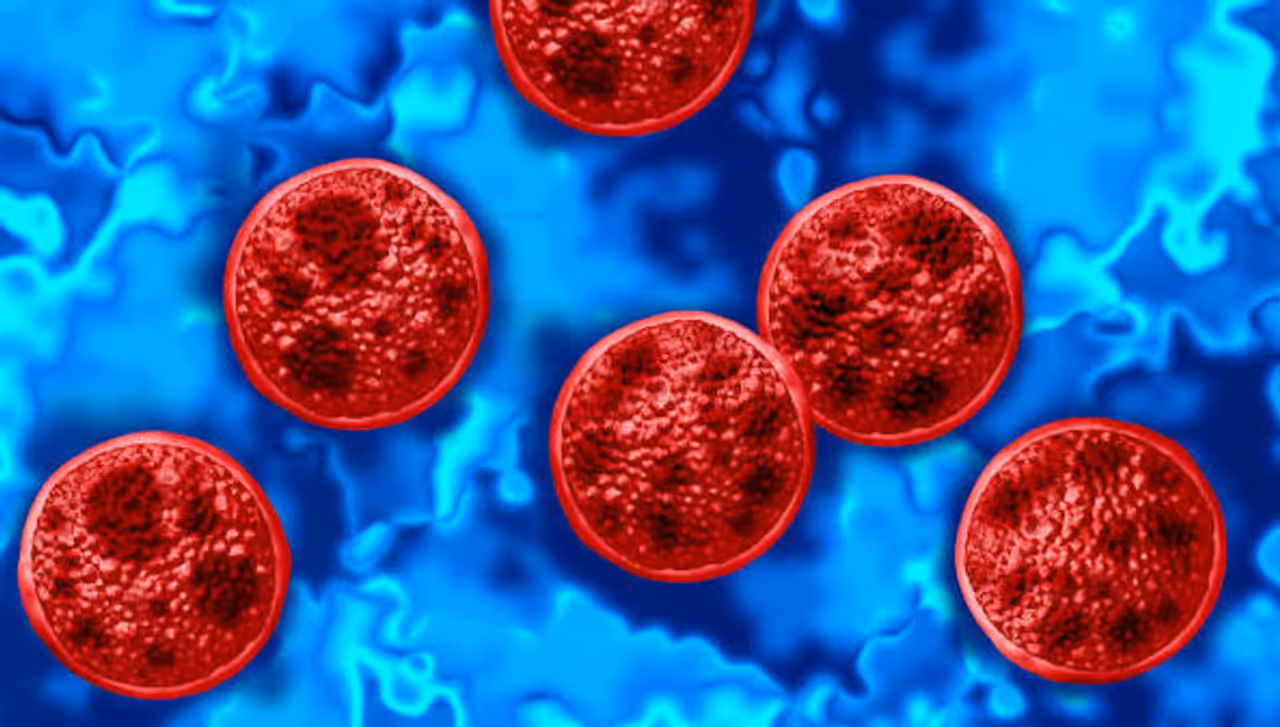 Cyclosporiasis outbreak: ಹೆಚ್ಚುತ್ತಿದೆ ಮತ್ತೊಂದು ಅಪಾಯಕಾರಿ ಕಾಯಿಲೆ Cyclosporiasis outbreak: ಹೆಚ್ಚುತ್ತಿದೆ ಮತ್ತೊಂದು ಅಪಾಯಕಾರಿ ಕಾಯಿಲೆ