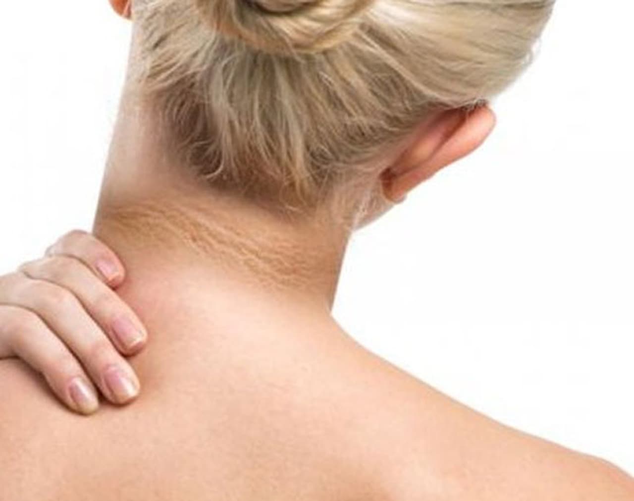 मानेवरचा काळेपणा, दुर्लक्षित पण गंभीर समस्या