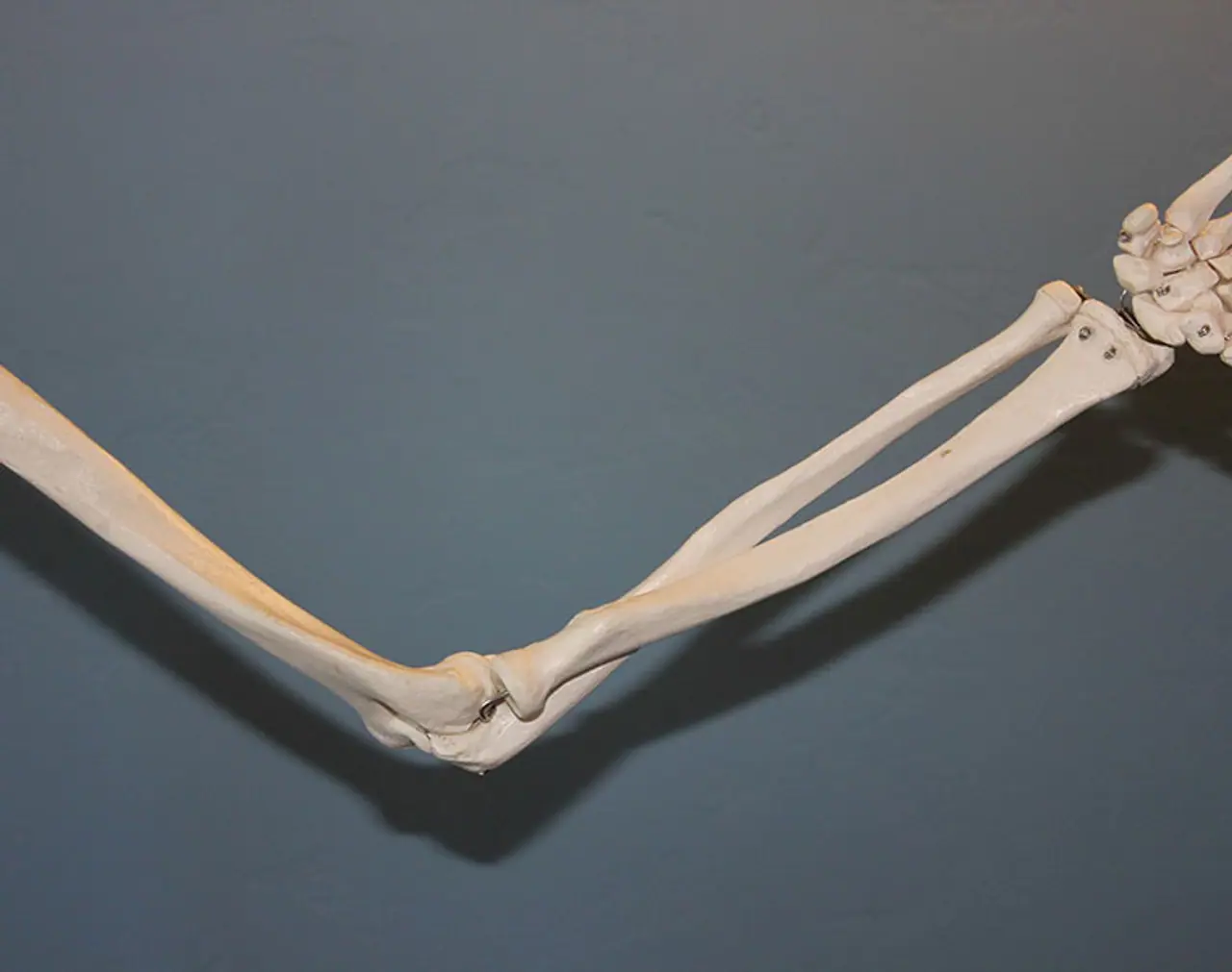 <p><strong>ದುರ್ಬಲ ಮೂಳೆಗಳಿಂದ ಈ ರೋಗಗಳು ಉಂಟಾಗಬಹುದು</strong><br />ಮೂಳೆಗಳು ದುರ್ಬಲವಾಗಿದ್ದರೆ, ರಿಕೆಟ್ಗಳು ಮತ್ತು ಆಸ್ಟಿಯೊಪೊರೋಸಿಸ್ ನಂತಹ ಕಾಯಿಲೆಗಳು ಬರಬಹುದು ಮತ್ತು &nbsp;ಲಘು ಗಾಯವನ್ನು ಹೊಂದಿದ್ದರೆ ಸಾಕು ಮೂಳೆ ಮುರಿಯುವ ಅಪಾಯವೂ ಹೆಚ್ಚು.</p>