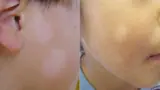 Recommended image2