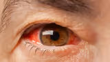 Recommended image1